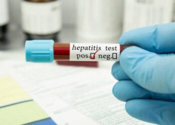 OMS alerta ante brote de hepatitis de origen desconocido