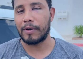 Nigropetense acusa a polícias municipales de torturarlo en celdas preventivas