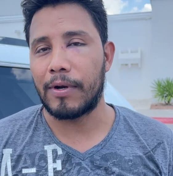 Nigropetense acusa a polícias municipales de torturarlo en celdas preventivas