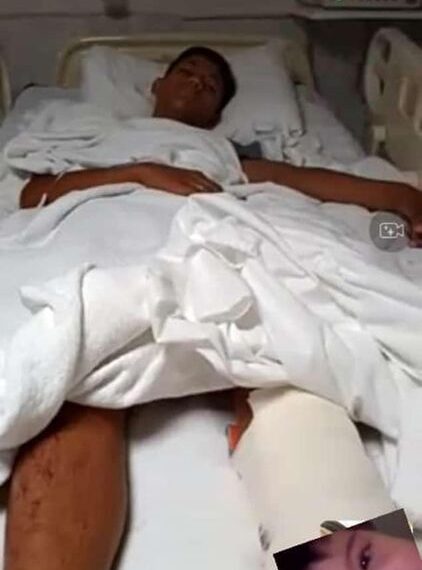 Familia de vendedor de burritos atropellado en Piedras Negras solicita apoyo para realizarle cirugía