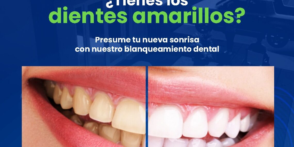 AVA Médica ofrece servicio dentales de alta calidad