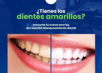 AVA Médica ofrece servicio dentales de alta calidad