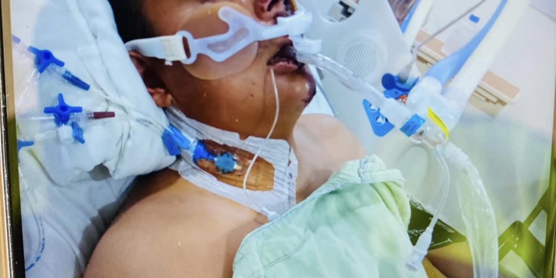 Piden ayuda para joven atropellado por ebrio conductor en PN