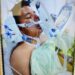 Piden ayuda para joven atropellado por ebrio conductor en PN