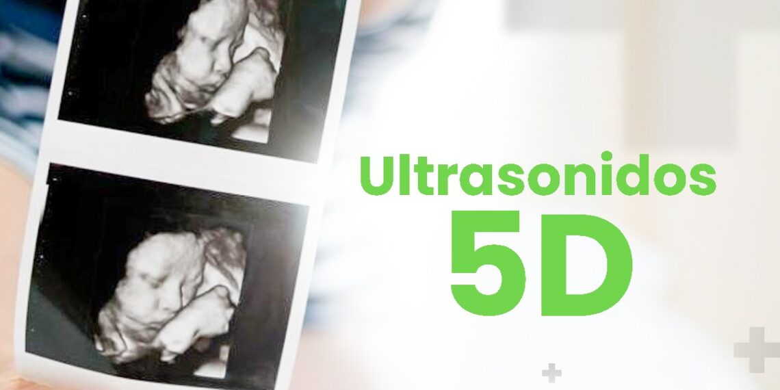 Moderno servicio de ultrasonido 5D en AVA Médica