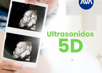 Moderno servicio de ultrasonido 5D en AVA Médica
