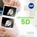 Moderno servicio de ultrasonido 5D en AVA Médica