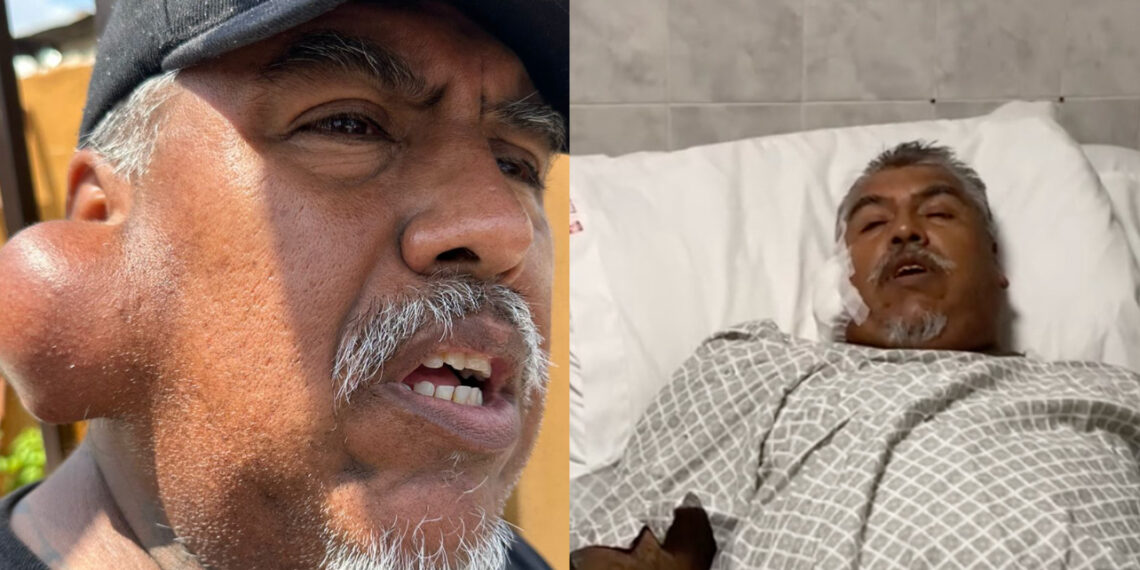 Extirpan tumor a adulto mayor con apoyo de Fundación Jacobo