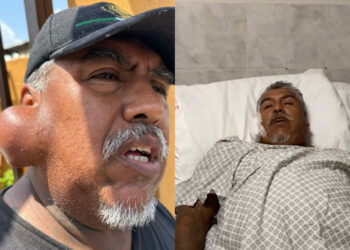 Extirpan tumor a adulto mayor con apoyo de Fundación Jacobo
