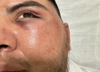 Denuncian sexto abuso policiaco del año; alcalde lo niega