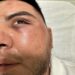 Denuncian sexto abuso policiaco del año; alcalde lo niega